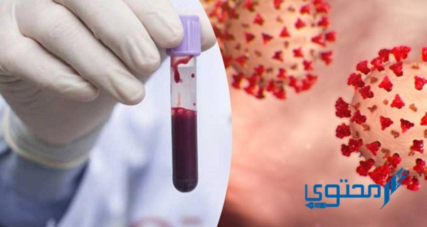 يمتاز الدم الذي يسري في الأوردة بأنه؟