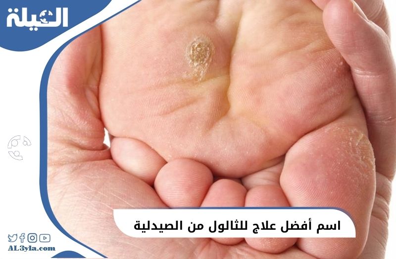 اسم أفضل علاج للثالول من الصيدلية