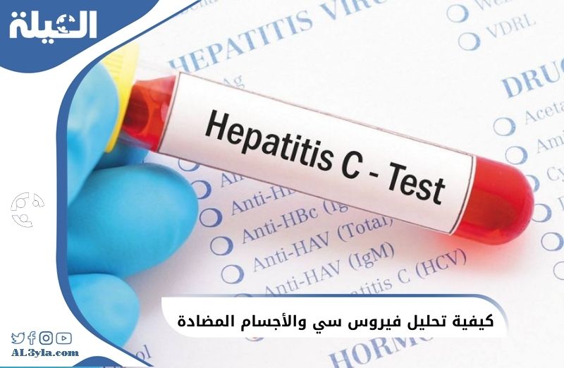 كيفية تحليل فيروس سي والأجسام المضادة