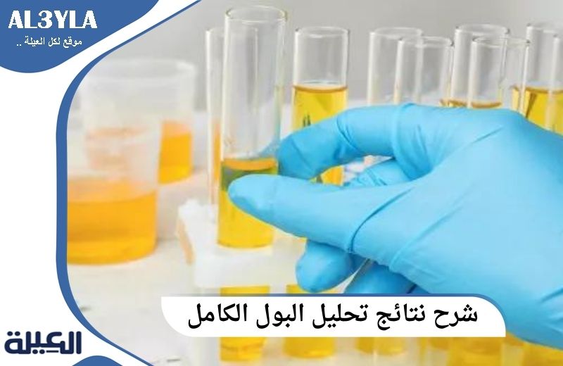 شرح نتائج تحليل البول الكامل