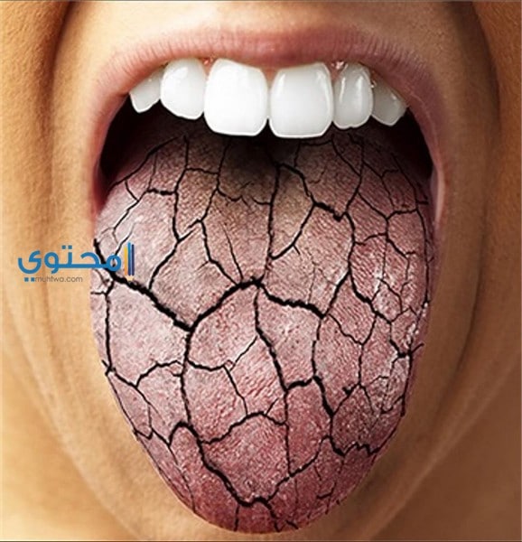 العطش في المنام