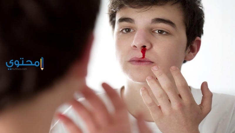 نزول دم من الأنف في المنام