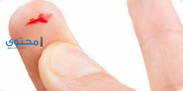 جرح اليد والجسم في المنام