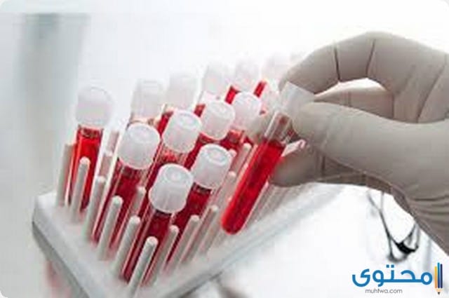 التحاليل في المنام