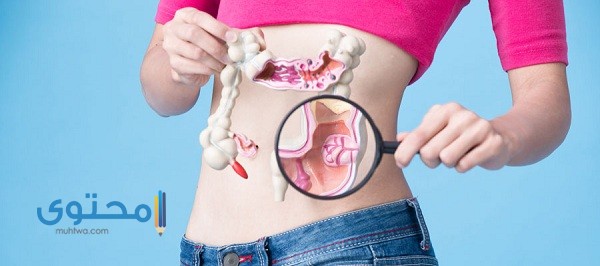 أعراض سرطان القولون