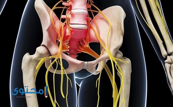 أهم أعراض عرق النسا وطرق علاجه