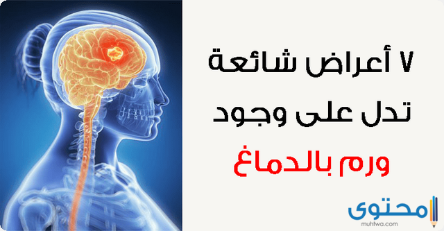 أعراض ورم المخ