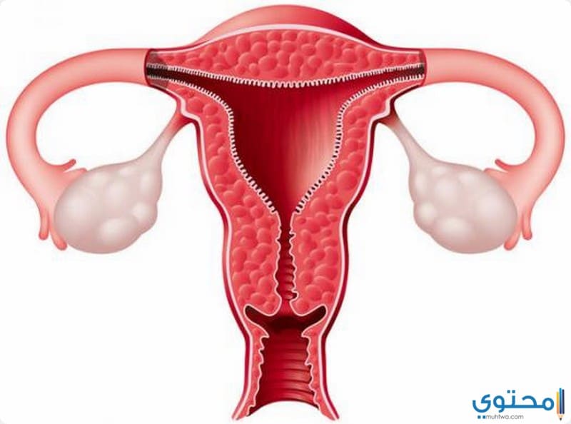 علاج ضعف المبايض