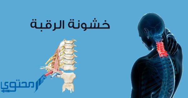 تجربتي مع خشونة الرقبة والتهاب المفاصل الروماتويدي