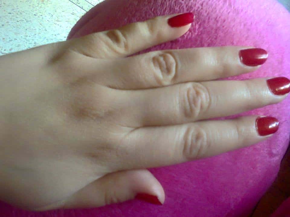 ترطيب الايد