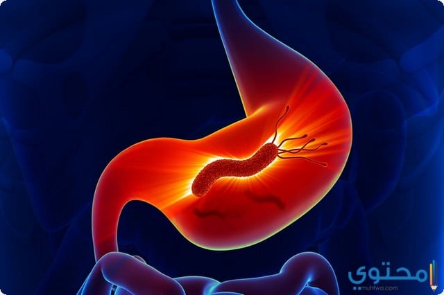 أعراض جرثومة المعدة