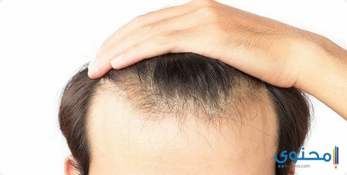 أسماء مراكز زراعة الشعر الطبيعي في الجزائر