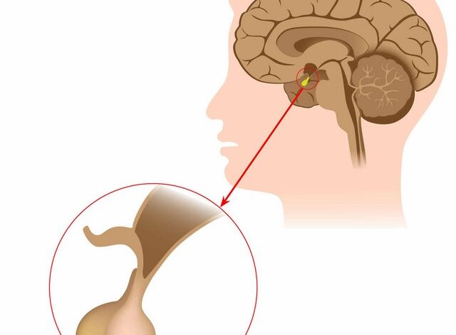 طرق علاج الغدة النخامية بالأعشاب