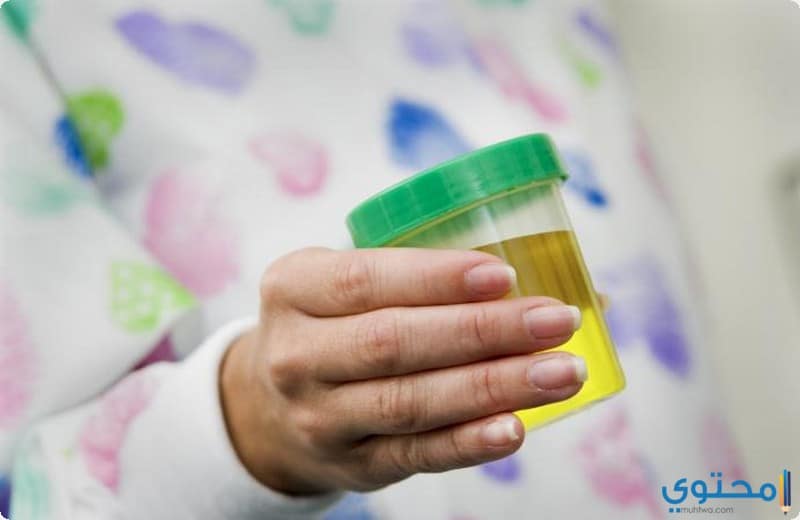 علاج صديد البول