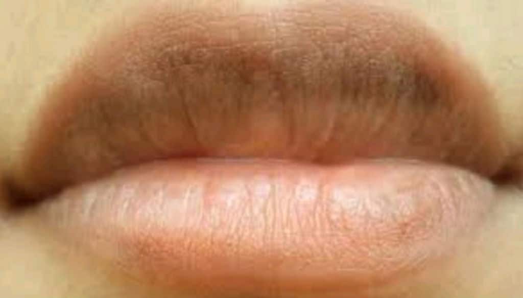 غمقان الشفاة