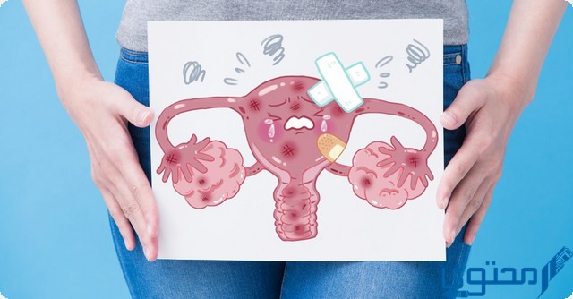 قلة دم الدورة