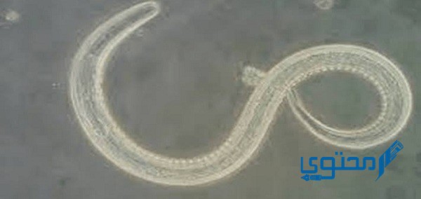 كيف أعرف أن بنتي فيها ديدان