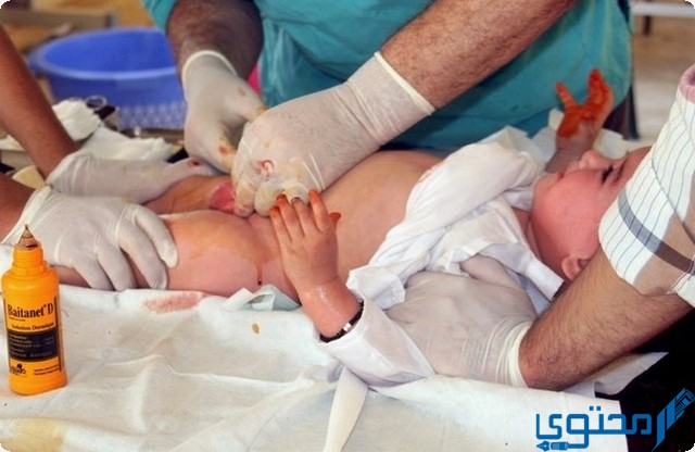 مراحل شفاء الختان