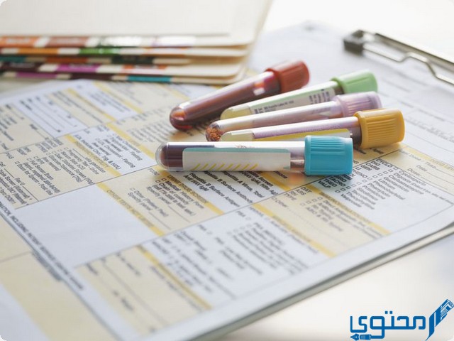 معنى كلمة Positive في تحليل الدم