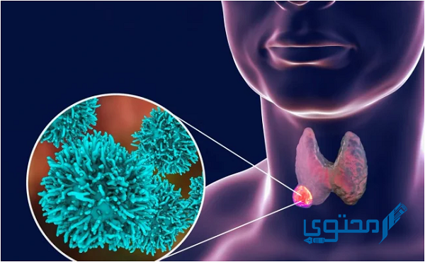 هل اليود المشع يزيد الوزن